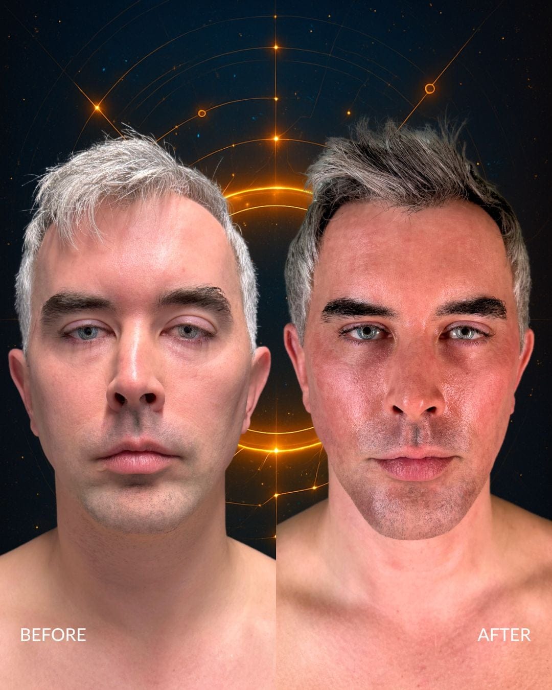 Male Facial Sculpting Before and After